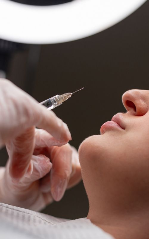 Tear trough med fillers